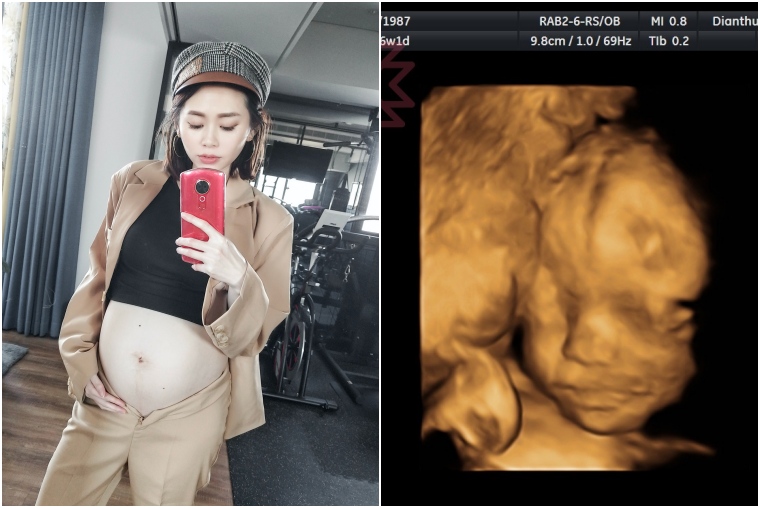 懷孕日記 第二孕期13 28週 4 7個月 高層次檢查 第一次胎動 喝糖水 一起過第一個西洋情人節 Stella 小美人 史黛拉